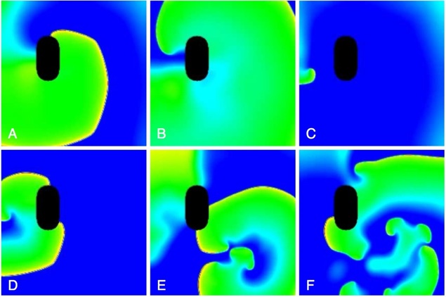 Simulation von AF in einem zweidimensionalen Ausschnitt des rechten Vorhofes