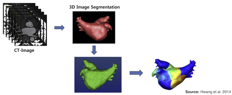 Cardiac Magnetic Resonance Image Segmentation