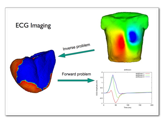 MRI Reconstruction as an Inverse Problem - ScienceDirect