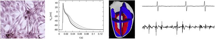 PRJ_2011-02-22_G_Seemann_fibrosis.jpg